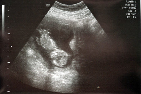 Baby 2