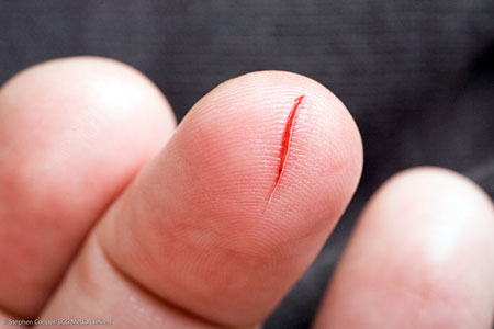 Gash